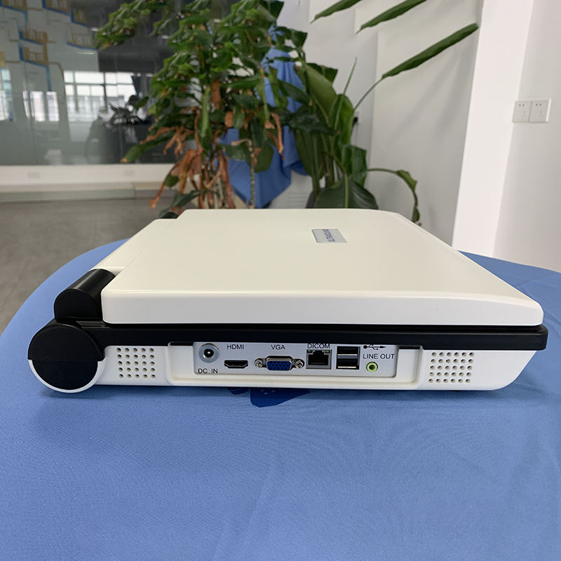 MN-E20 Hospital Medical 3D Laptop Ultrasound Machine Full Digital Ultrasound Scanner with Multi-language