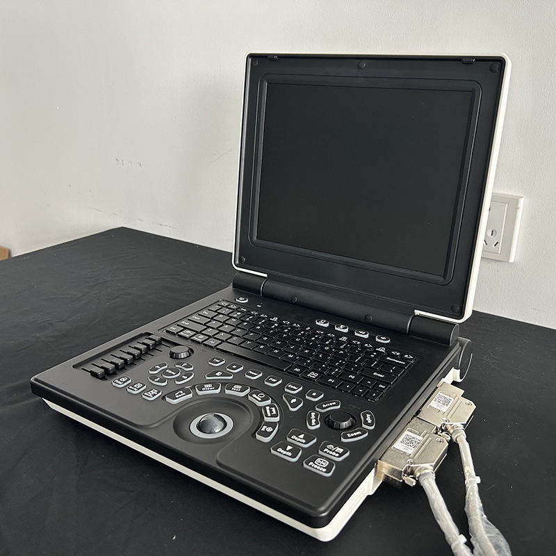 MN-E20 Hospital Medical 3D Laptop Ultrasound Machine Full Digital Ultrasound Scanner with Multi-language